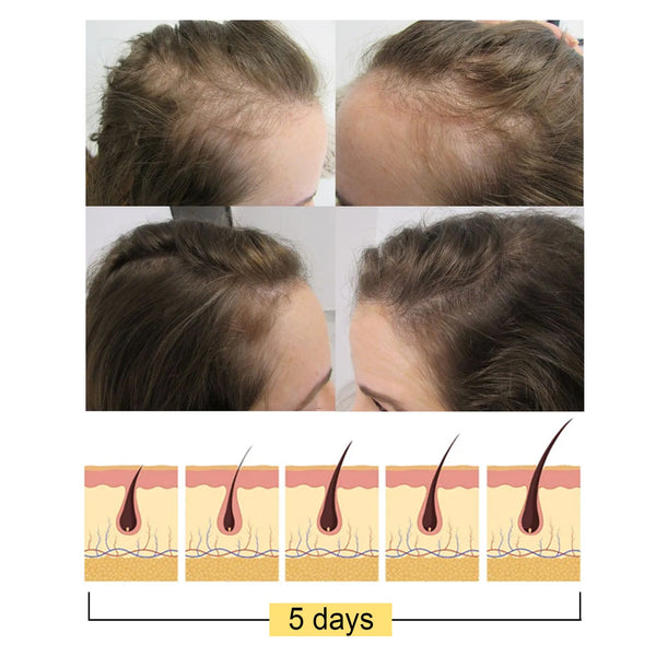 Ginger Dense Hair Soap, Moisturizes Hair Ends And Roots Cleansing Scalp Hair Care Shampoo Soap