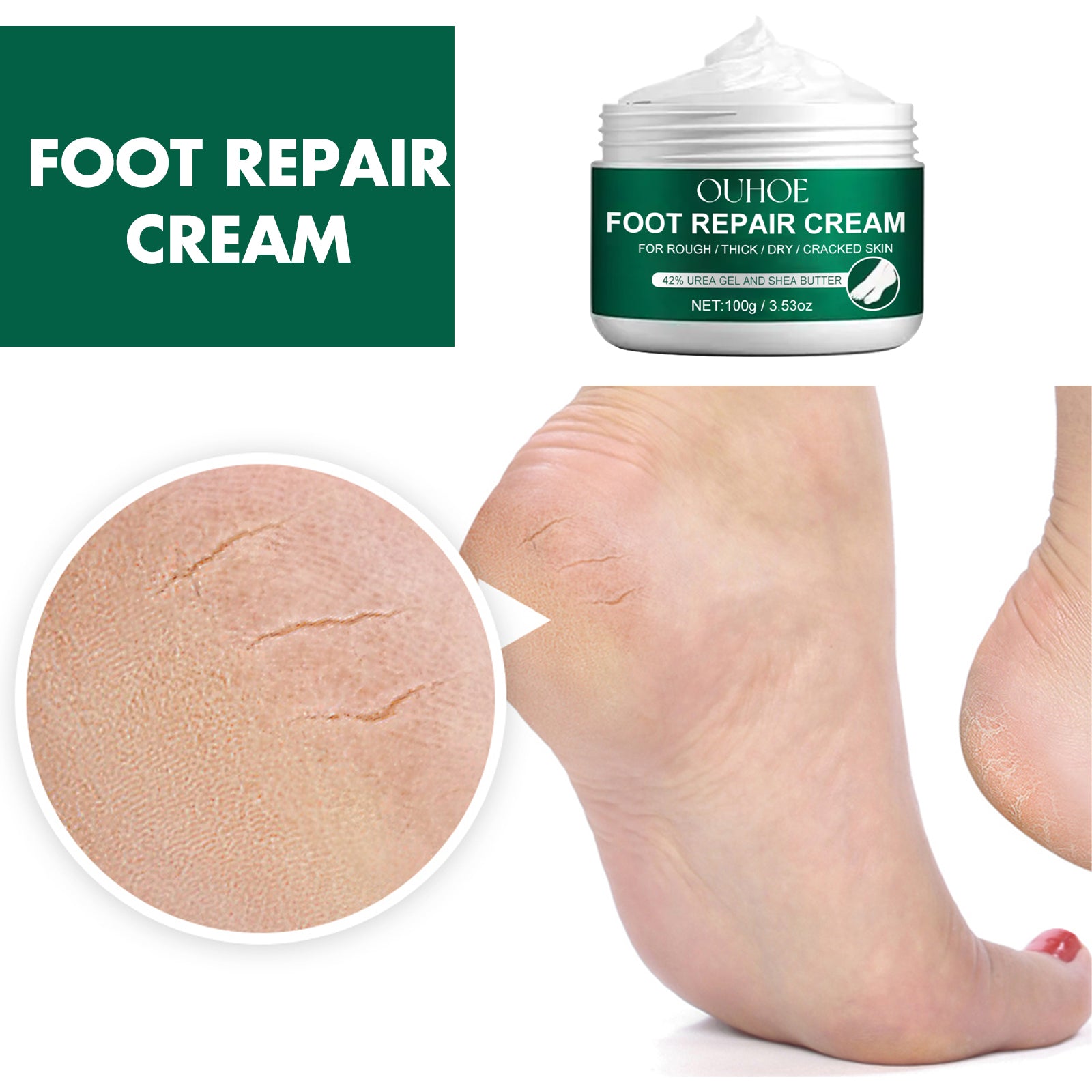 Foot Repair Cream, Repair Heel Crack Dry Itching Skin Nourishing Moisturizing Moisturizing Foot Care Cream