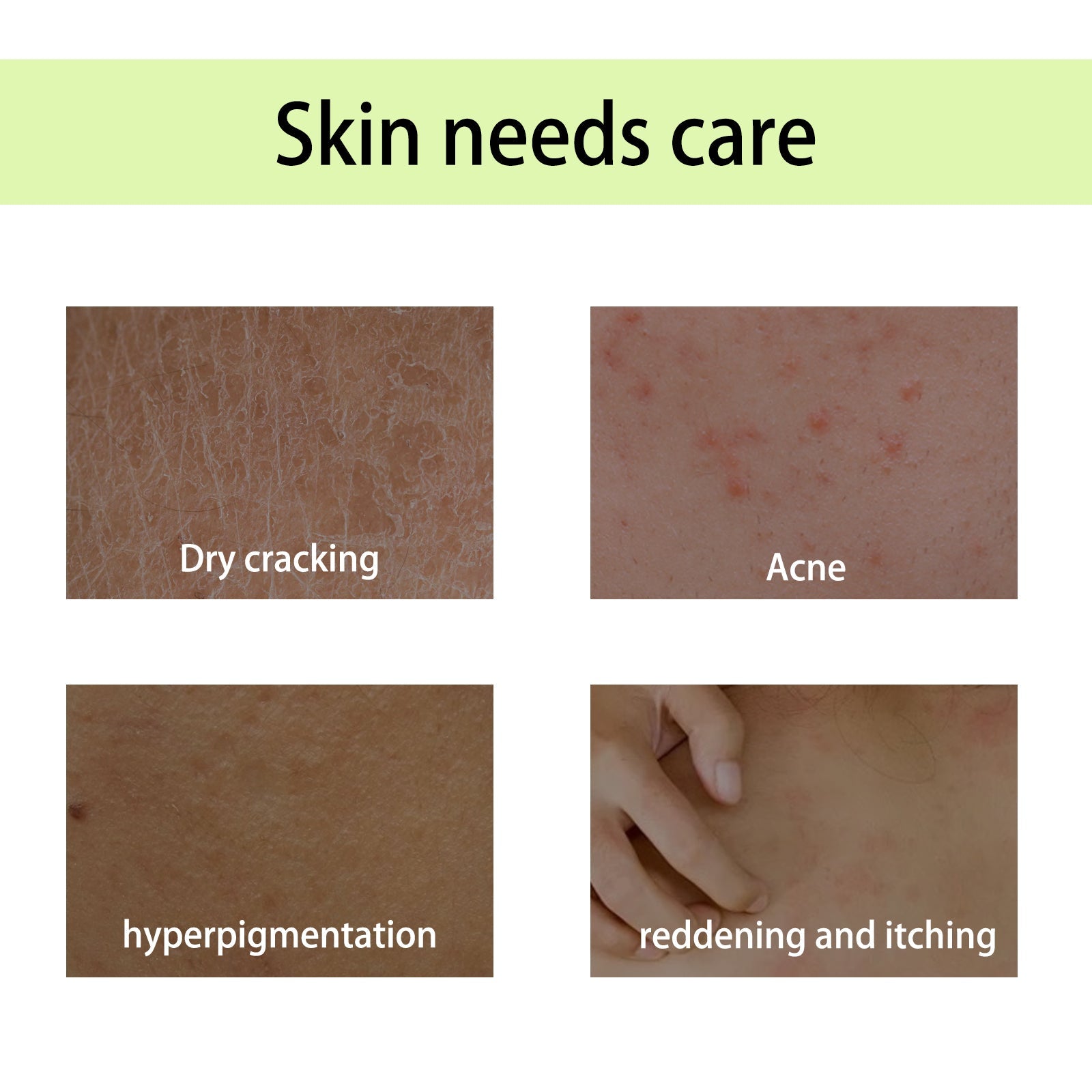 Handcrafted Body Oil, Moist Curing Firming Skin Relief Fatigue Plant Aroma Aromatic Therapy Oil