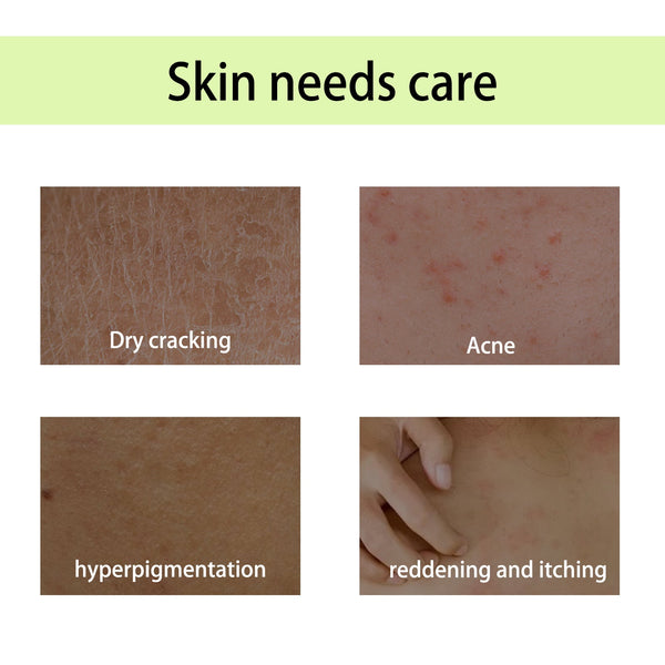 Handcrafted Body Oil, Moist Curing Firming Skin Relief Fatigue Plant Aroma Aromatic Therapy Oil