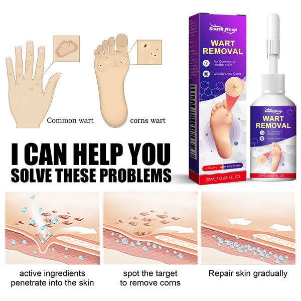 Remove Chicken Eye Lotion Extra Clear Remove Corns Skin Care Chicken Calluses Foot Pad Gram Warts