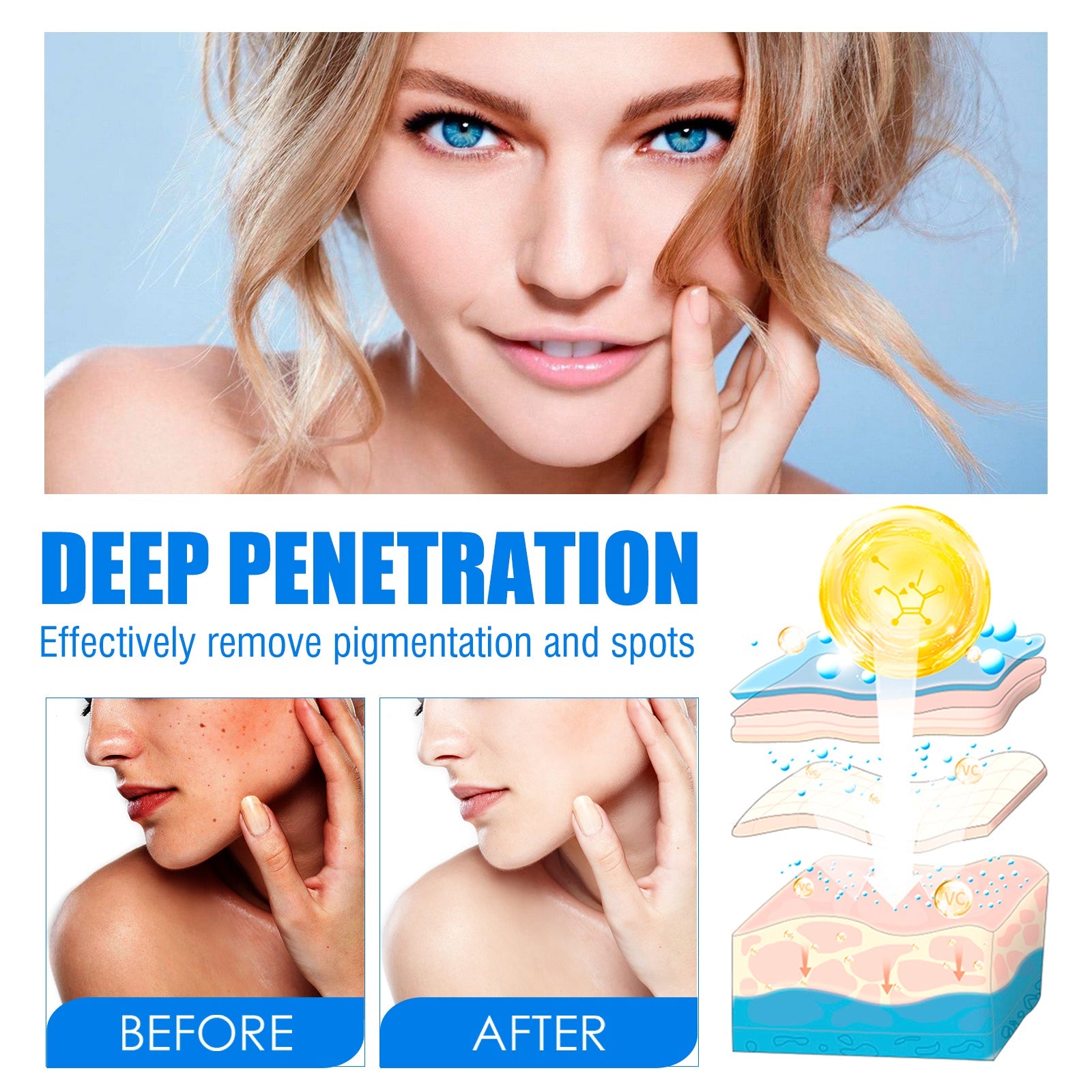 Blemish Cream, Whitening Skin Reduce Melanin Melasma Stains And Hydrating Cream