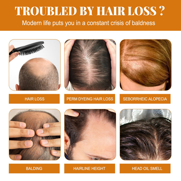 Horse Oil Shampoo Deep Cleaning Scalp Dandruff Control Oil Control Fluffy Hair Moisturizing Hair Care