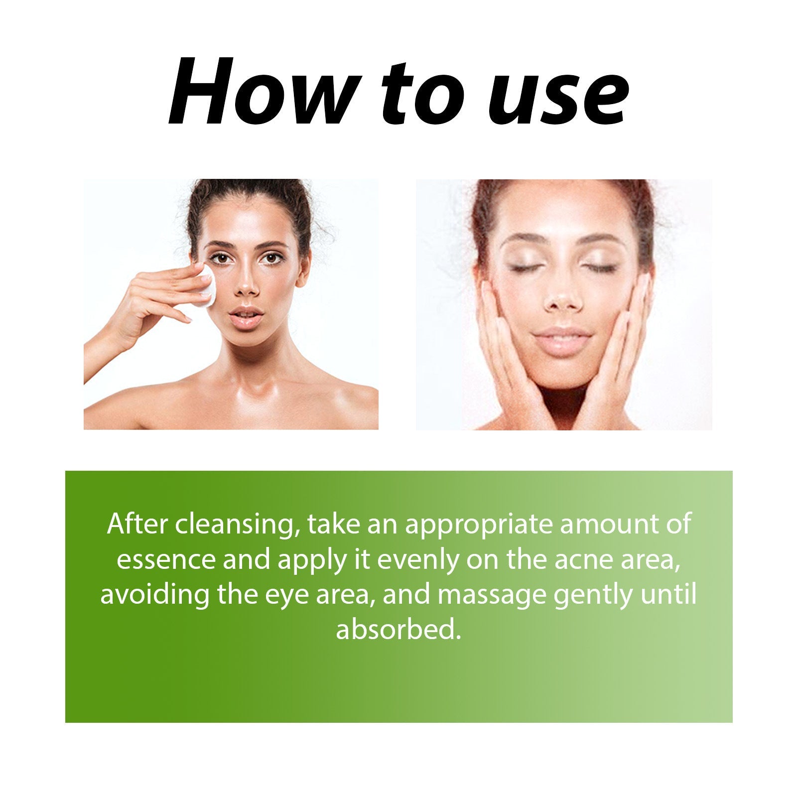 Herbal Acne Serum, Reduce Acne Pimples With A Comprehensive Moisturizing Moisturizer