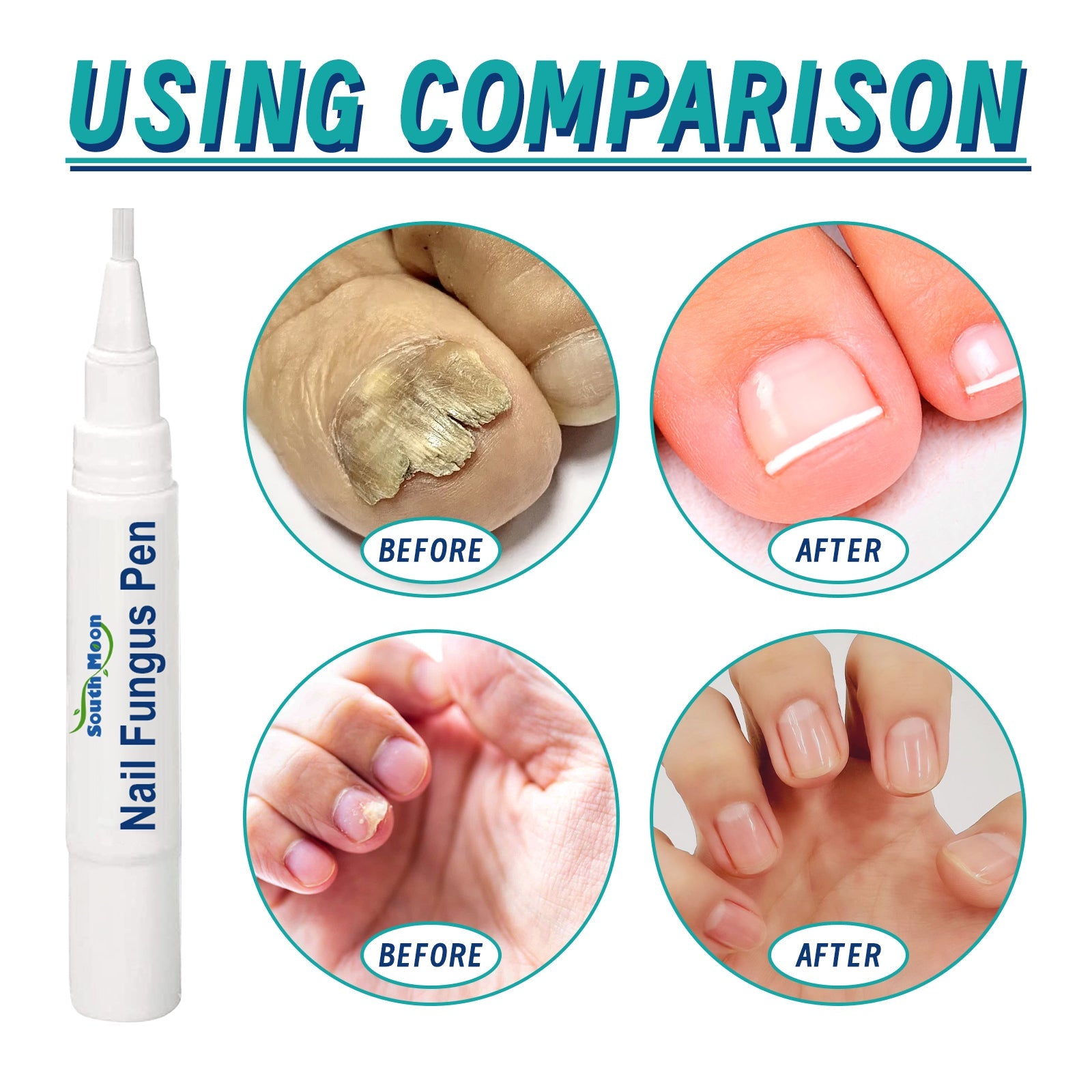 Nail Repair Pen, Repair Hands And Feet Gray Nails Brightening Nails Soft Nails Thickening Nails Moisturizing Care