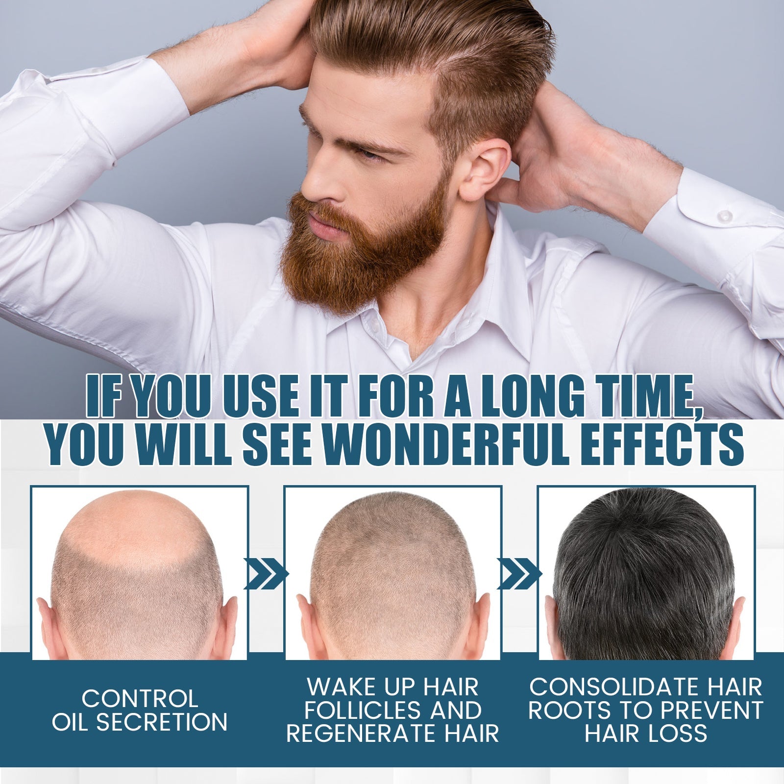 Hair Essence Spray, Prevent Hair Loss Repair Hair Dry And Frizzy Moisture And Dense Hair Essence