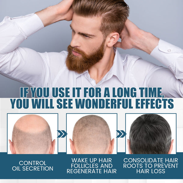 Hair Essence Spray, Prevent Hair Loss Repair Hair Dry And Frizzy Moisture And Dense Hair Essence