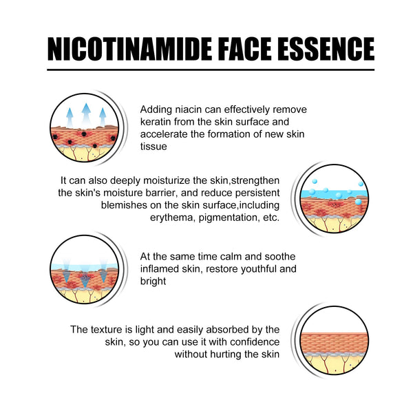 Nicotinic Acid Face Essence Lighten Acne Marks, Moisturize Pores, Shrink And Whiten Skin Beauty Essence