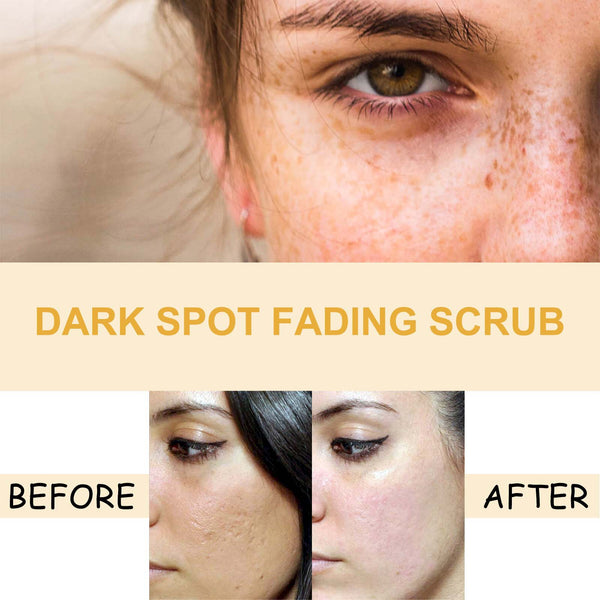 Turmeric Skin Care Set Hydrating Moisturizing Cleanser Refreshing Oil Control Subtle Lines Nourishing Cleansing Set