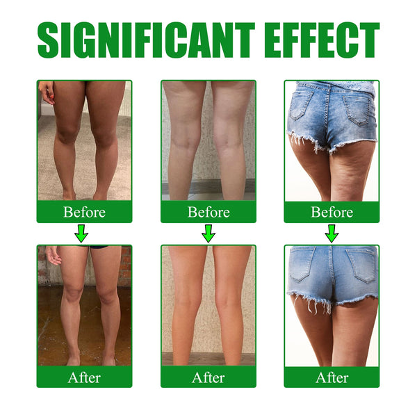 Moxa Leg Lift Paste, Tight Leg Fat, Anti-Orange Peel Shape Lazy People To Create Beautiful Slim Legs