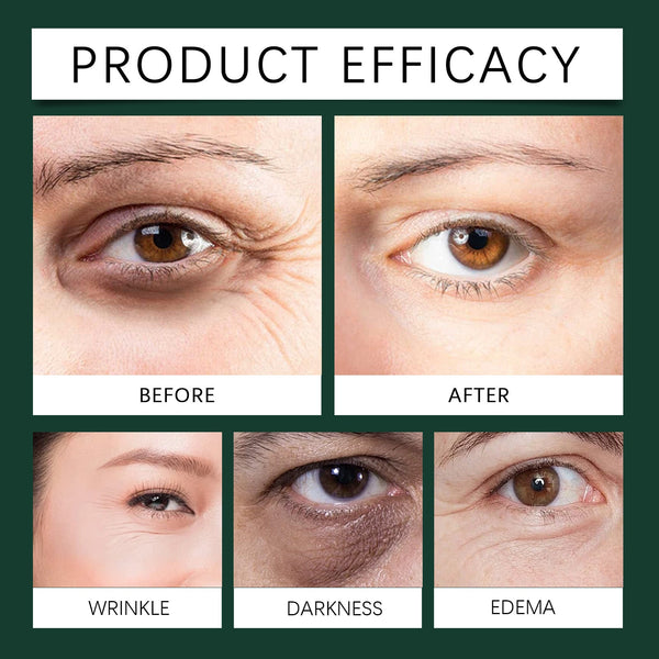 Mint Essence Eye Roller, Fade Fine Lines Crow's Feet Moisturizing Elastic Eye Anti-Wrinkle