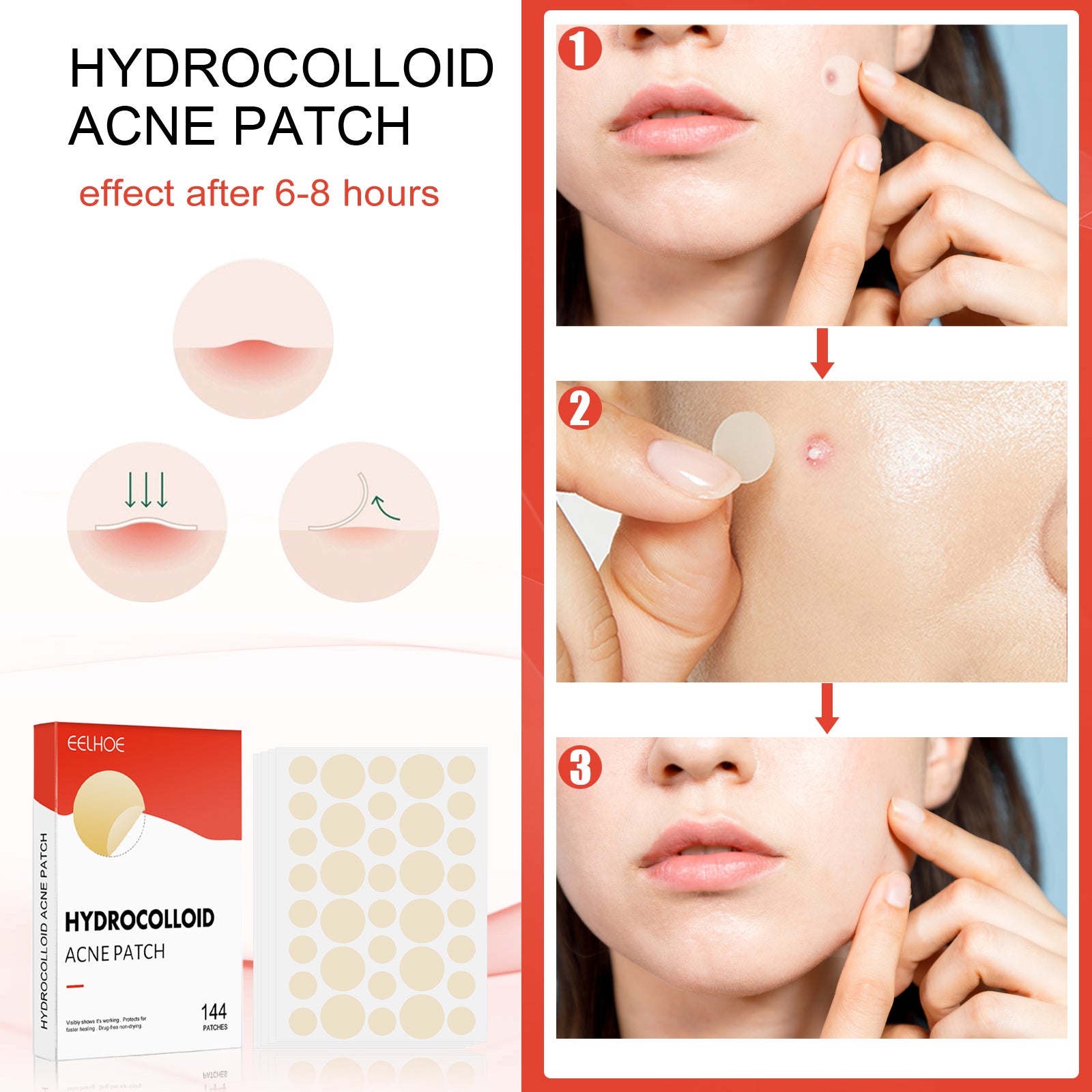 Hydrocolloid Acne Patch Face Invisible Makeup Closed Mouth Acne Clear Acne Waterproof Breathable Facial Treatment