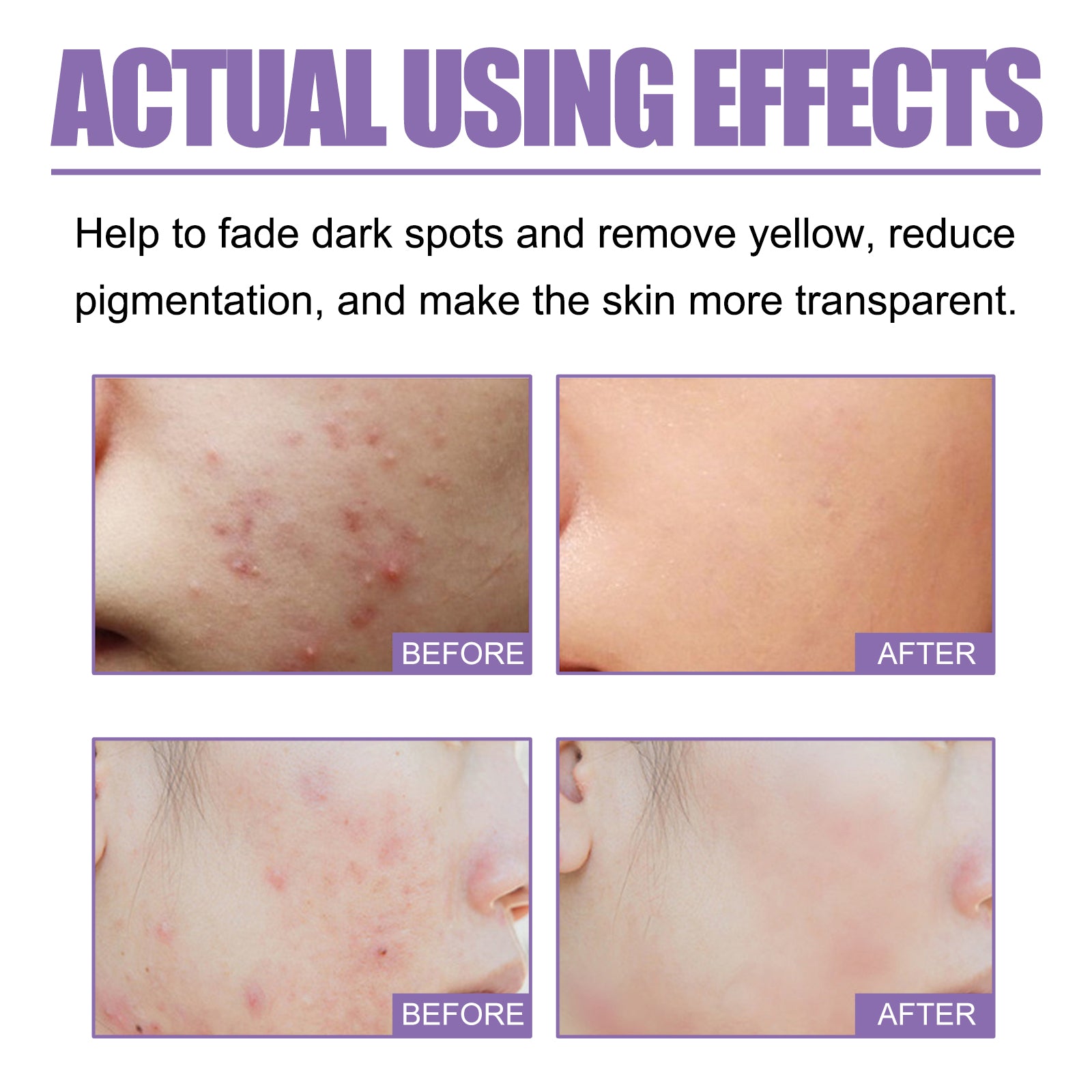 Lavender Oil Control Acne-Cleansing Soap For Cleansing Facial Skin Pores Oil Control Acne-Moisturizing Cleansing Soap