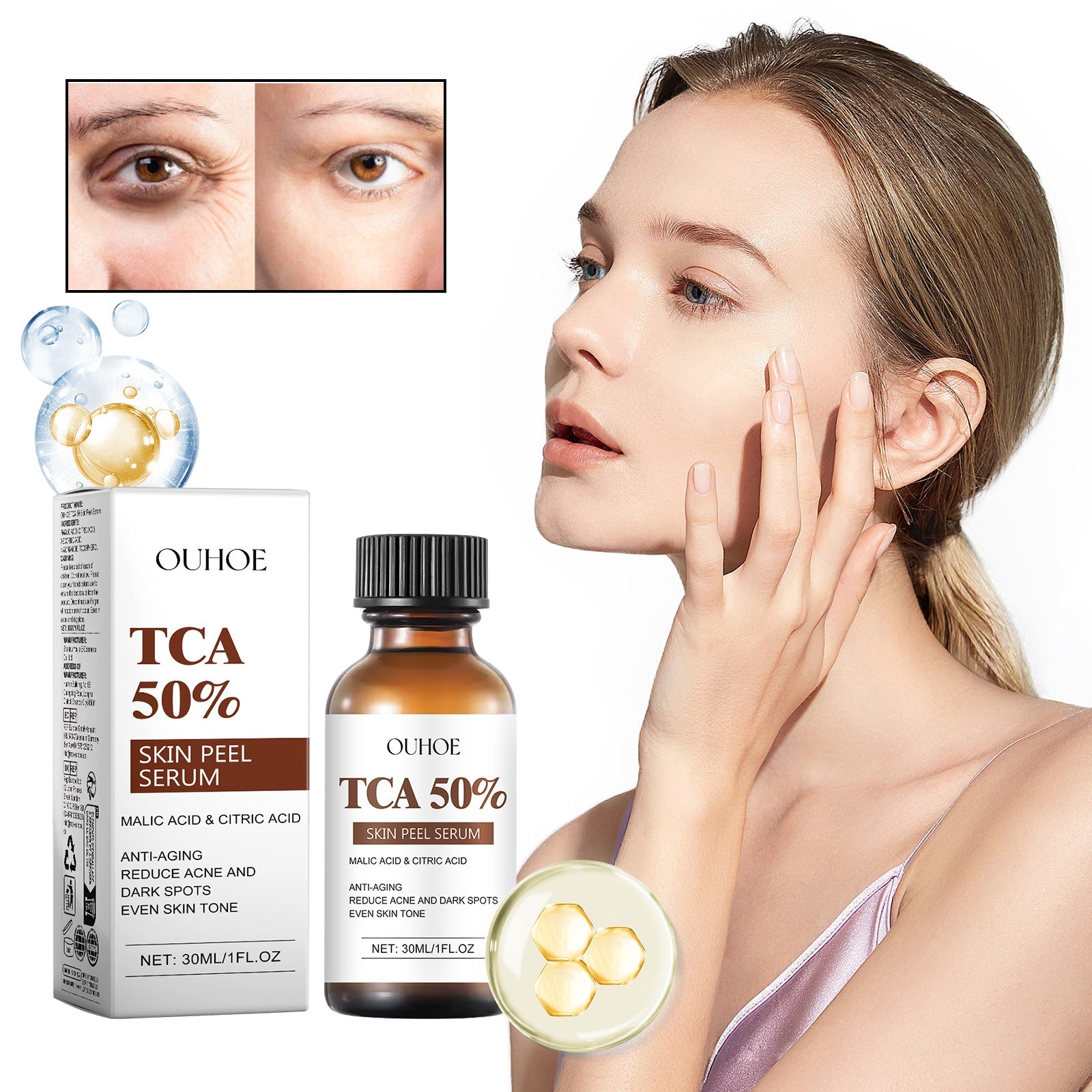 TCA 50 Skin Peel Serum, It Moisturizes Brightens The Firming Skin Fade Wrinkles This Skin Cream