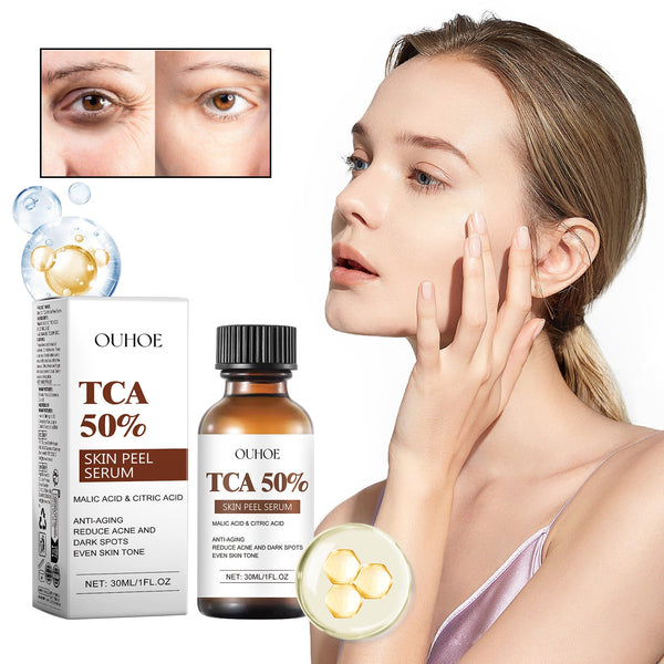 TCA 50 Skin Peel Serum, It Moisturizes Brightens The Firming Skin Fade Wrinkles This Skin Cream