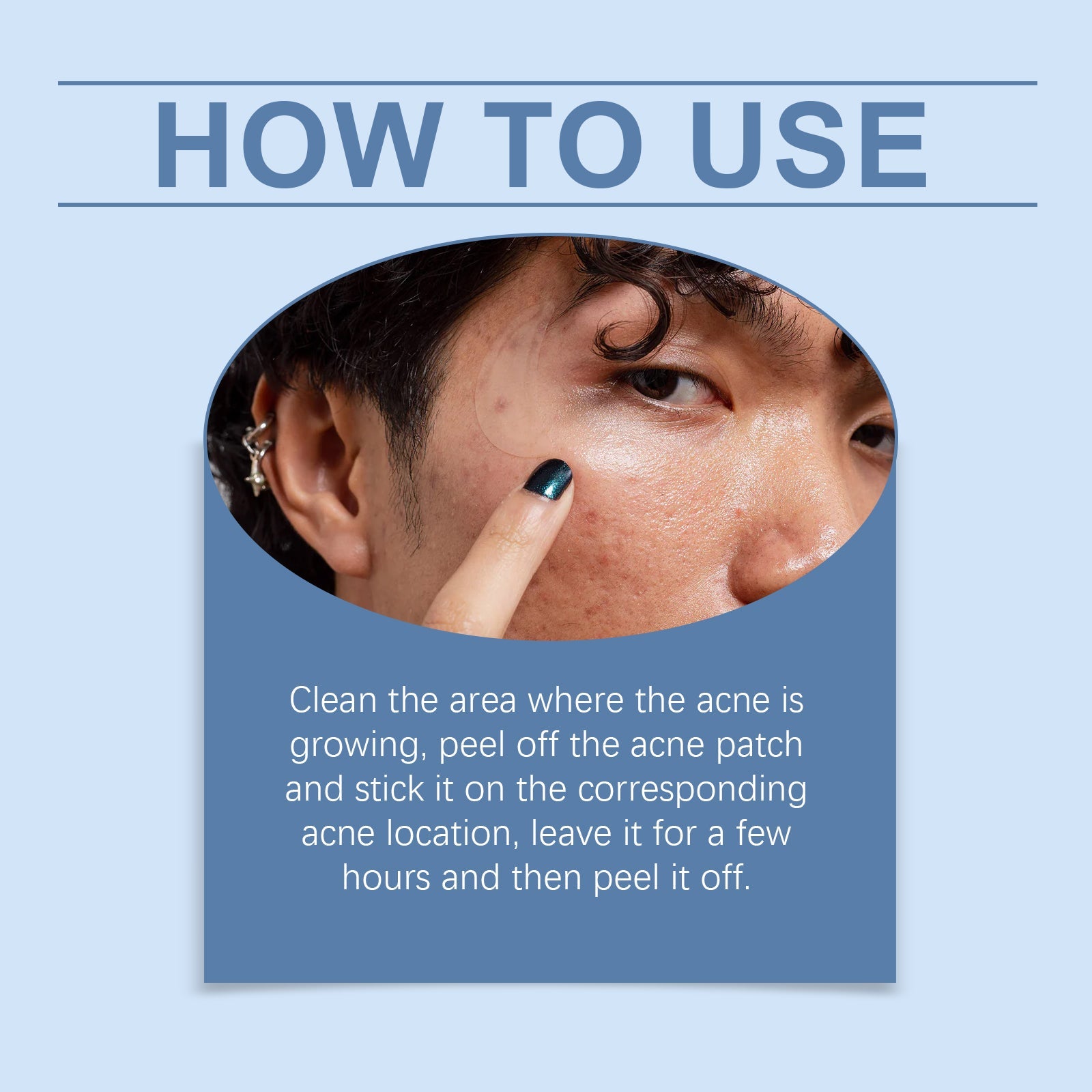 Moon Acne Patch Repair Acne Skin Breathable Facial Skin Gentle Cleansing Patch