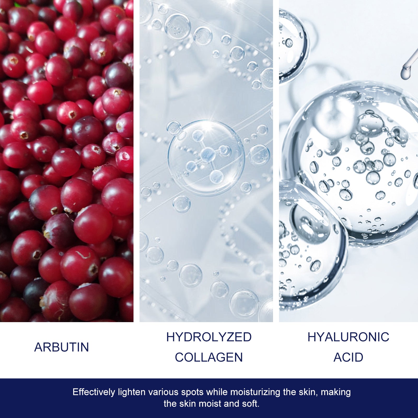 Skin Genesis Spot Whitening Cream, Filling Water To Moisten Soft Delicate Chun White Brighten The Melanin Of Skin Cream