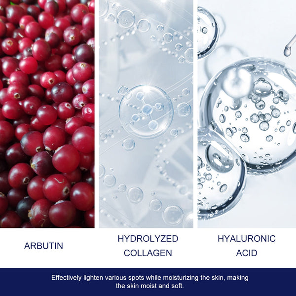 Skin Genesis Spot Whitening Cream, Filling Water To Moisten Soft Delicate Chun White Brighten The Melanin Of Skin Cream