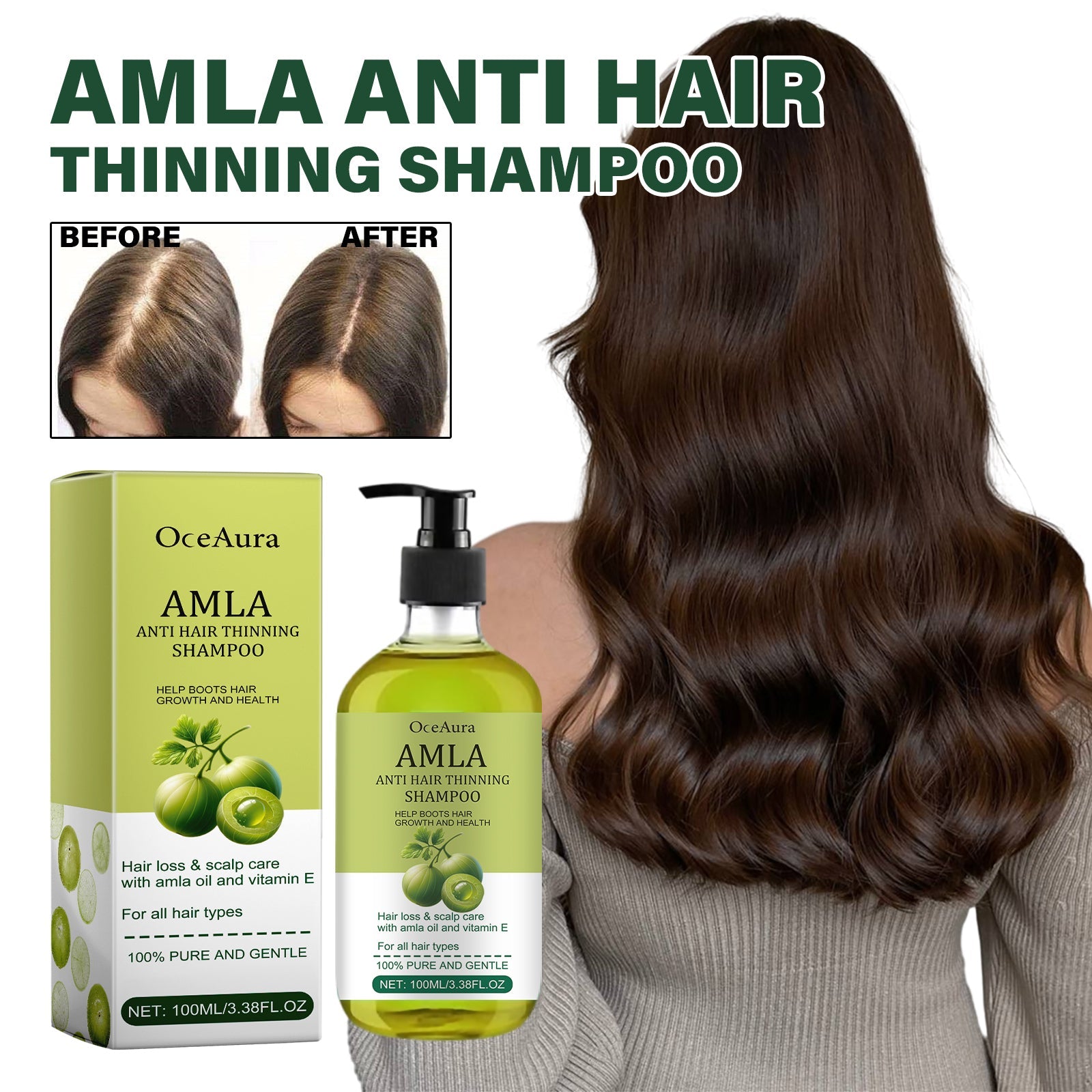 Amla Anti Hair Thinning Shampoo, Scalp Cleanness Moist Smooth Shiny Hair, Dense Hair Wash Protect Suits
