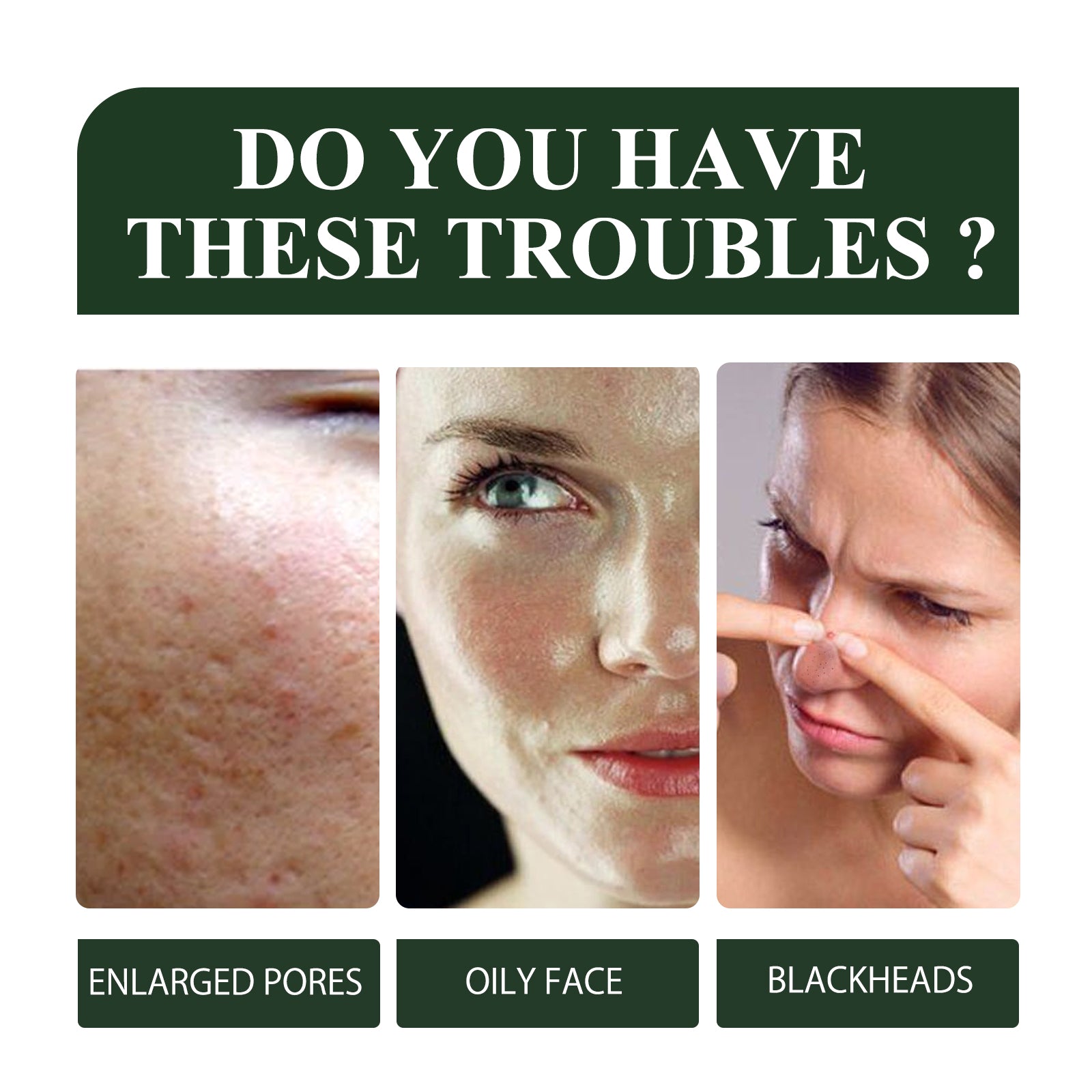 Green Tea Blackhead Removal Mask Deeply Cleanses Skin, Tightens Pores And Lightens Blackheads