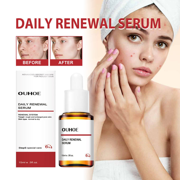 Mandelic Acid Daily Update Essence, Acne-Removing And Acne-Closing Repair Brightening Fruit Acid Essence