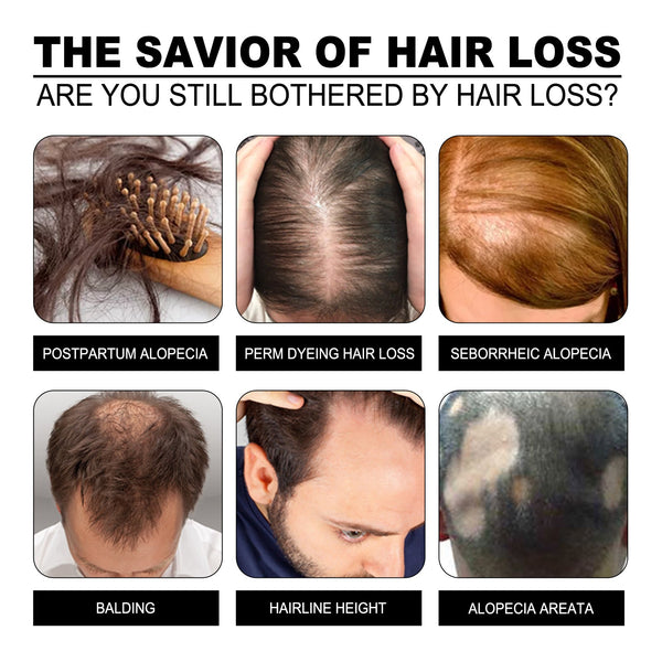 Ginger Dense Hair Soap, Moisturizes Hair Ends And Roots Cleansing Scalp Hair Care Shampoo Soap