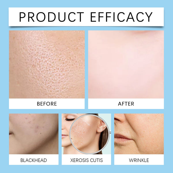 Hyaluronic Acid Face Serum, Compact Light Stripes Desalt Blain Brightens The Hydrating Essence