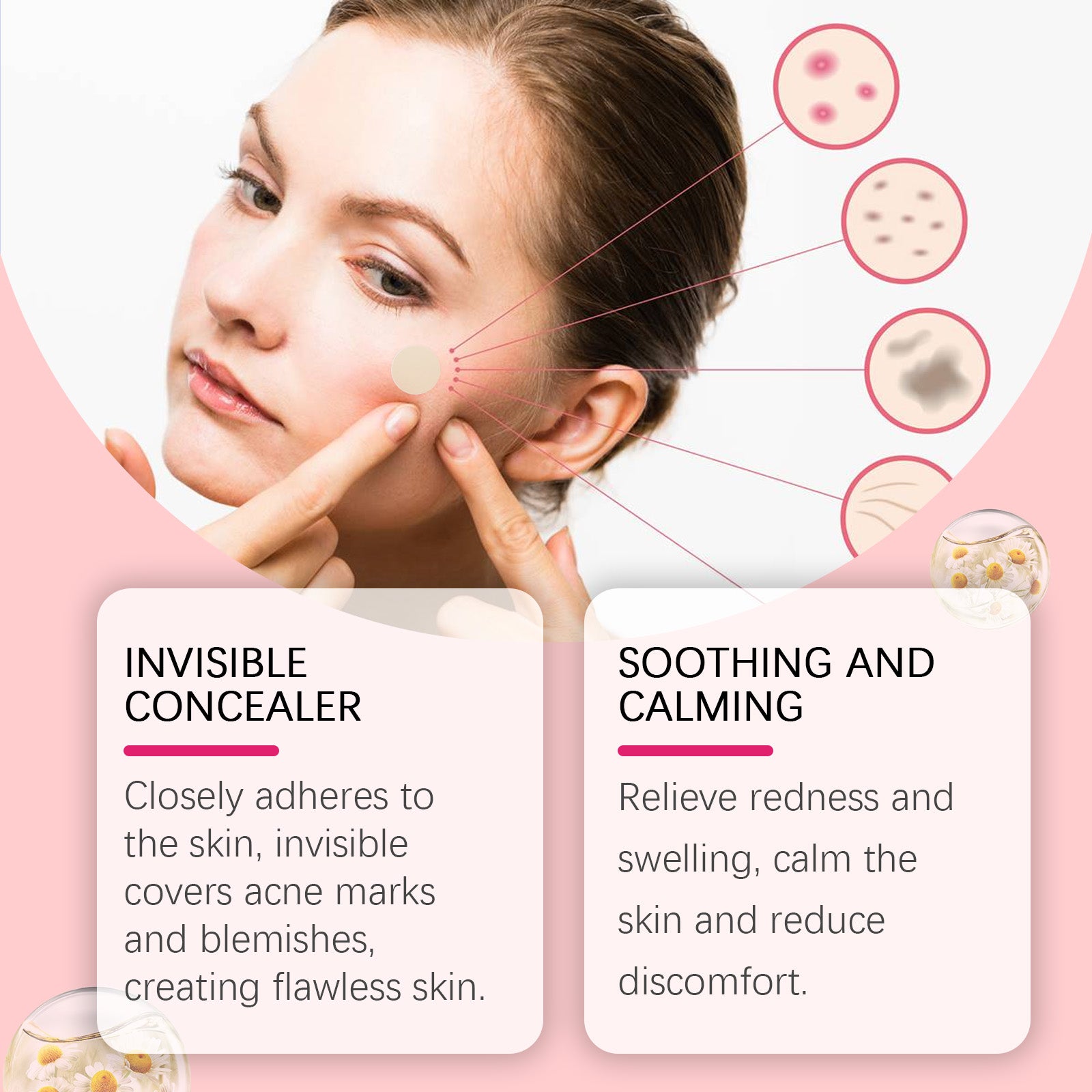 Repair Acne Patch, Facial Cleansing Cover Acne Skin Moisturizing Gentle Skin Cream