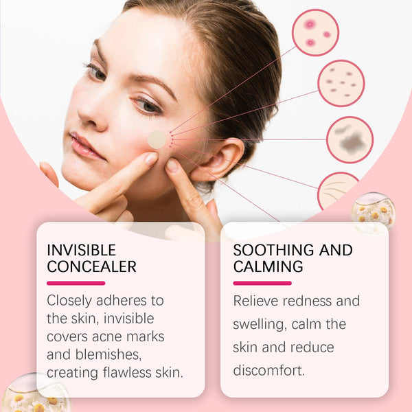 Repair Acne Patch, Facial Cleansing Cover Acne Skin Moisturizing Gentle Skin Cream