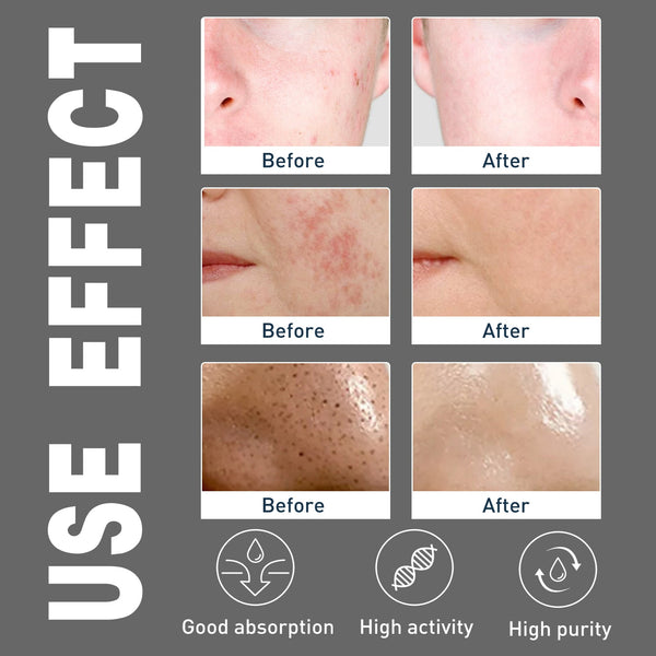 Men's Amino Acid Oil Control Face Wash, Deep Clean Acne Print Delicate Pores Whitening Brightening Skin