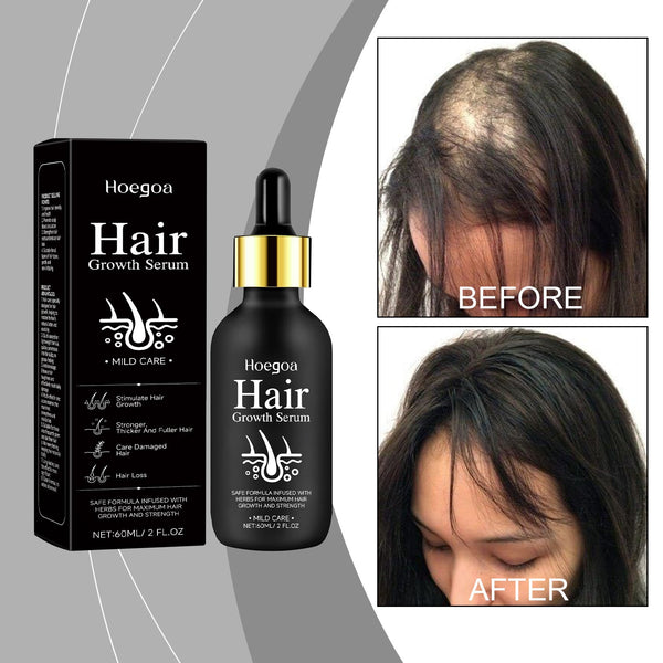 Hair Care Serum, Strengthens Hair And Nourishes Scalp Care Daily Massage Treatment Serum