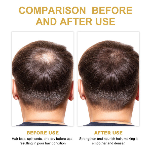 Hair Dense Oil, Scalp Cleaning Care Fluffy Soft Repair Dry Hair Impetuous Solid Hair Dense Hair Essential Oil