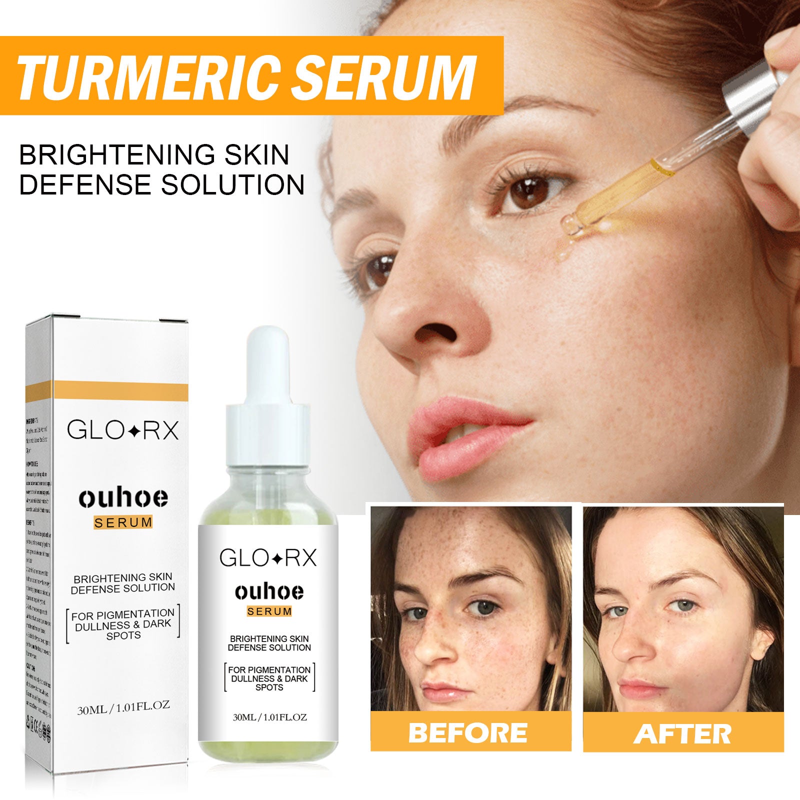 Turmeric Whitening Spot Serum, Lighten Freckle Spots Brightening Skin Hydrating Serum