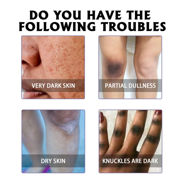 Whitening Skin, Lighten Dull Skin Elbow Black Hydrating, Brightening, Moisturizing And Rejuvenating Essence