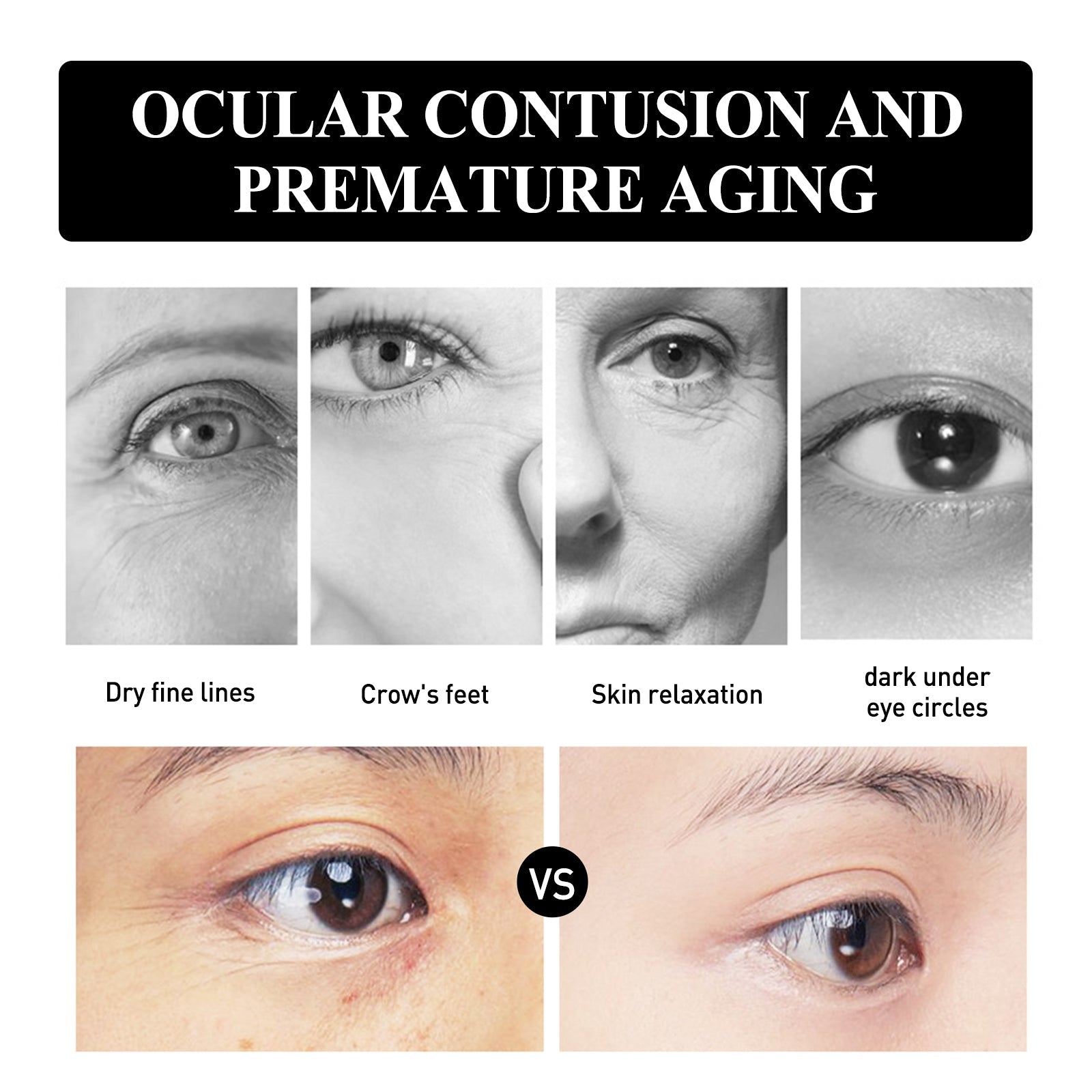 Eye Firming And Lifting Cream Moisturizes And Relieves Dry Lines, Hydrates And Improves Fine Lines