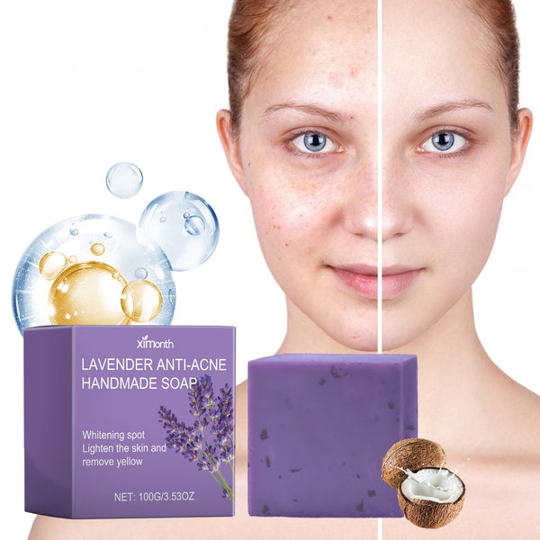 Lavender Oil Control Acne-Cleansing Soap For Cleansing Facial Skin Pores Oil Control Acne-Moisturizing Cleansing Soap