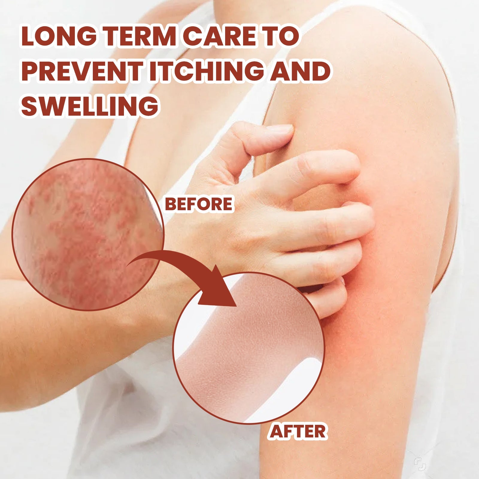 Breaking Itch King, Relieve Hand And Foot Moss Skin Moss Redness Repair Skin Itching Skin Care Cream