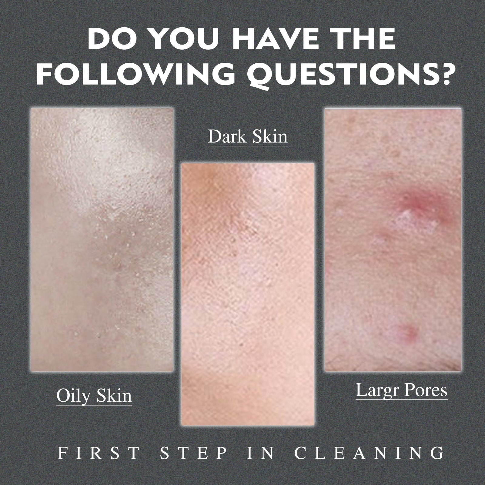 Men's Amino Acid Oil Control Face Wash, Deep Clean Acne Print Delicate Pores Whitening Brightening Skin