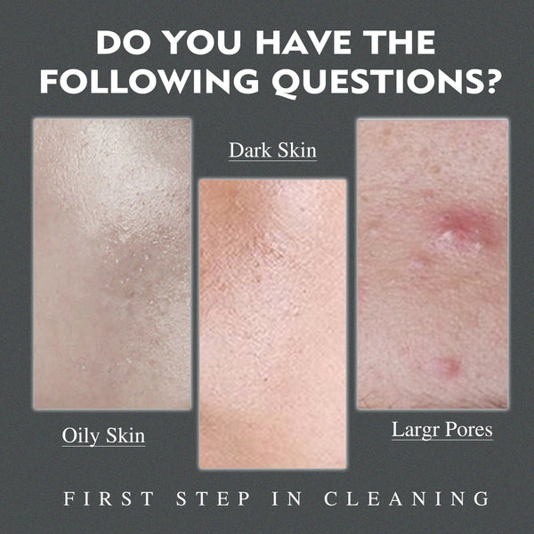 Men's Amino Acid Oil Control Face Wash, Deep Clean Acne Print Delicate Pores Whitening Brightening Skin