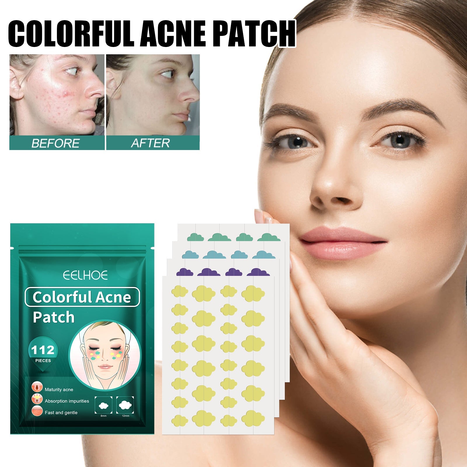 Colorful Acne Patch, Repair Pit Acne Print Smooth Skin Lightening Spot Clear Acne Facial