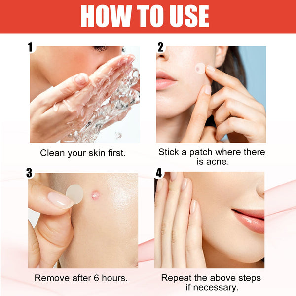 Hydrocolloid Acne Patch Face Invisible Makeup Closed Mouth Acne Clear Acne Waterproof Breathable Facial Treatment