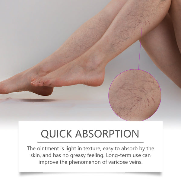 Herbal Leg Care Cream, Pamper, Massage, Repair And Relieve Uncomfortable Legs