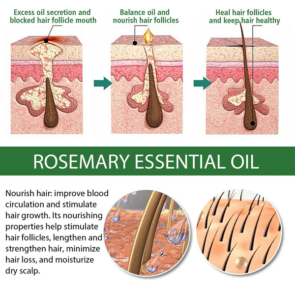Multi-Effect Rosemary Essential Oil, Strengthens Hair Moisturizes And Thickens Hair And Skin Care Multi-effect Essential Oil