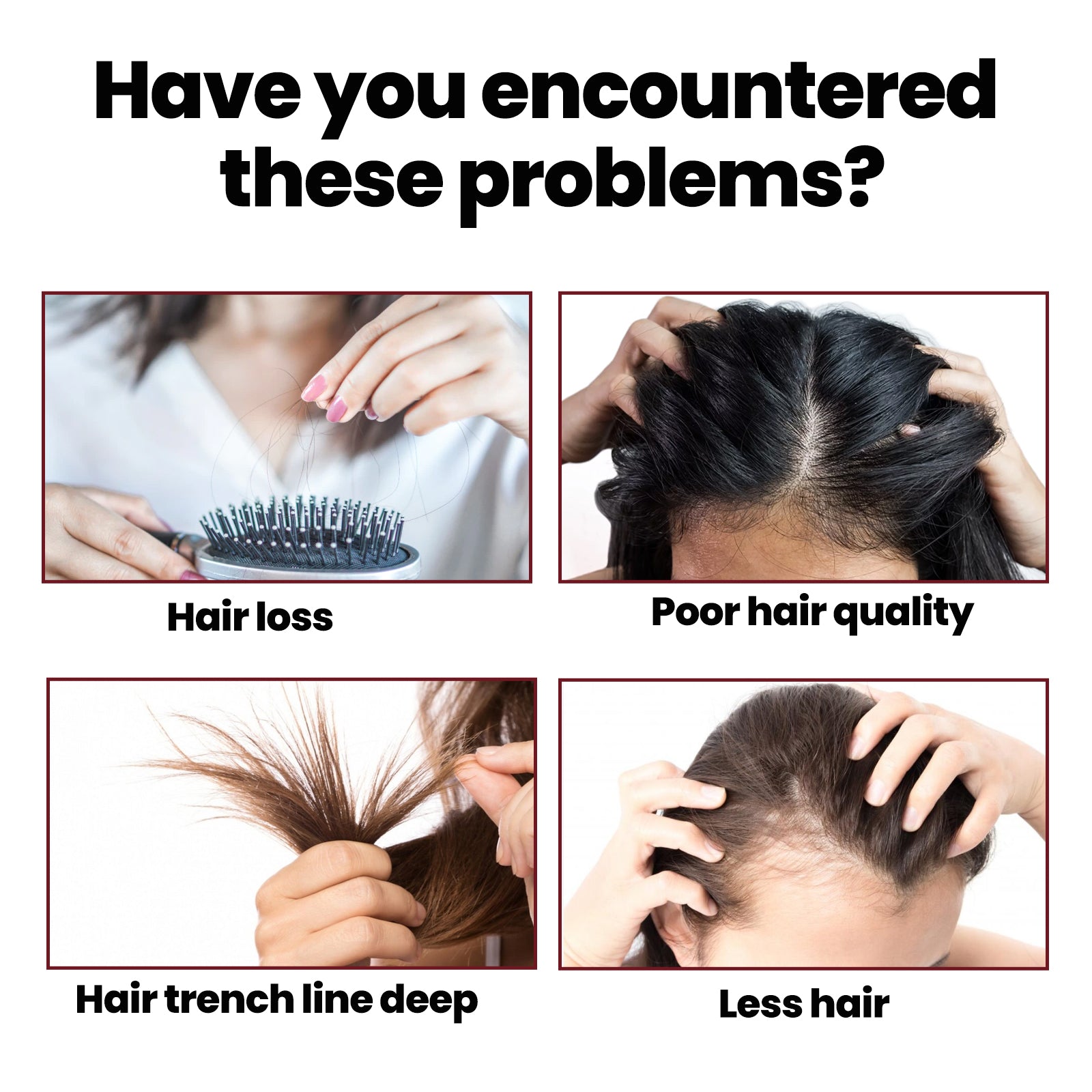 Hair Intensive Essence, Moisturizes Hair Roots, Fast Growing Prevents Loss And Strengthens Hair Care Essence