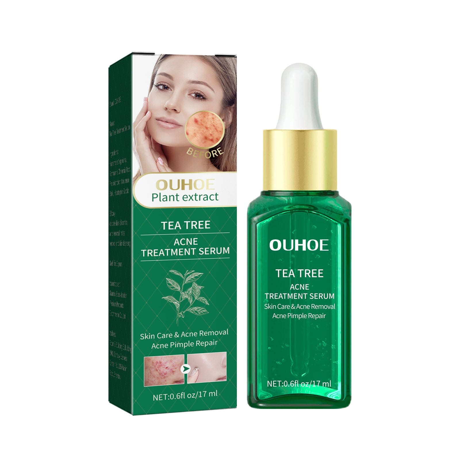 Tea Tree Oil Acne Serum, Remove Acne, Clear Acne, Repair Skin, Lighten Acne Printing Face Essence